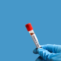Book Vitamin Blood Test